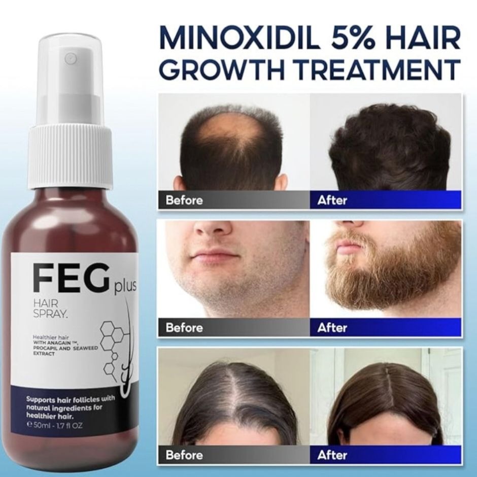 FEG Plus swiftly Hair Growth Spray