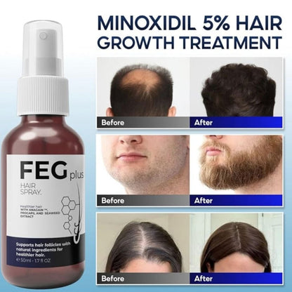 FEG Plus swiftly Hair Growth Spray